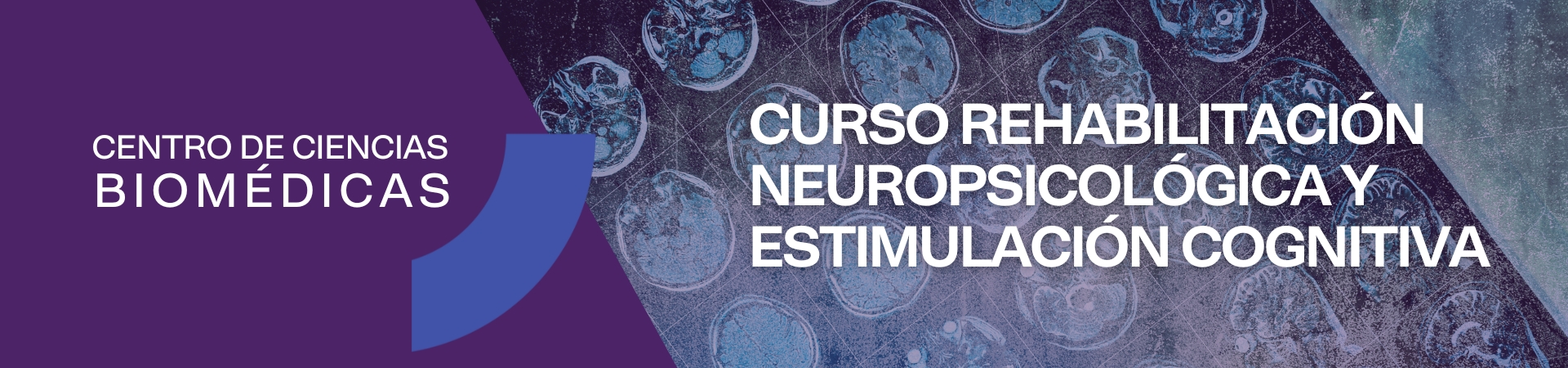 Curso Rehabilitación neuropsicológica y estimulación cognitiva